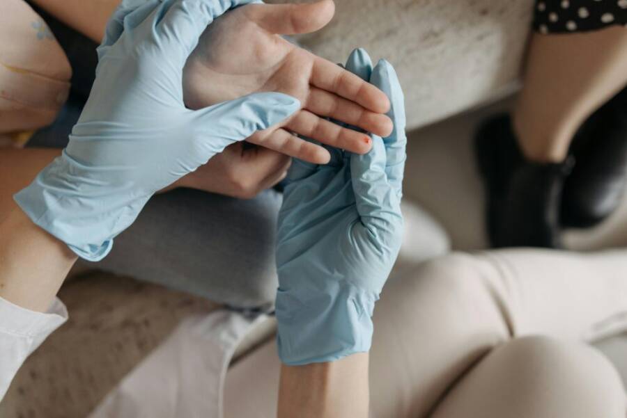 A medical professional wearing blue gloves examines a small wound on a person