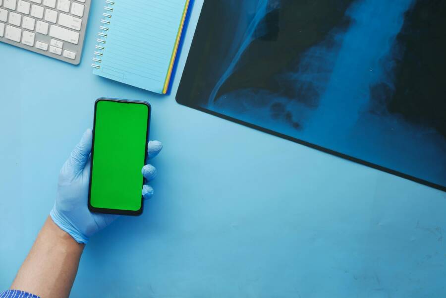 Close-up of a hand in a glove holding a smartphone with a green screen next to x-ray on a blue desk.